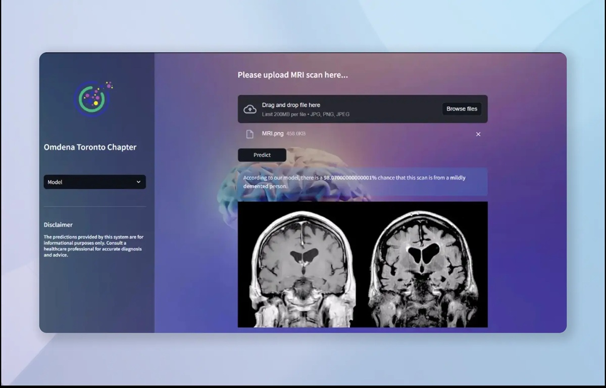 Omdena Built an AI System for Early Alzheimer's Detection with 99.22% Accuracy